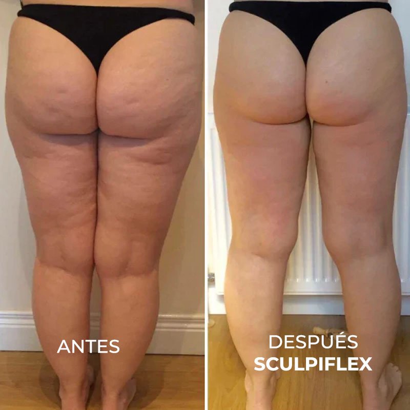 The Original Sculpiflex™ 3-in-1