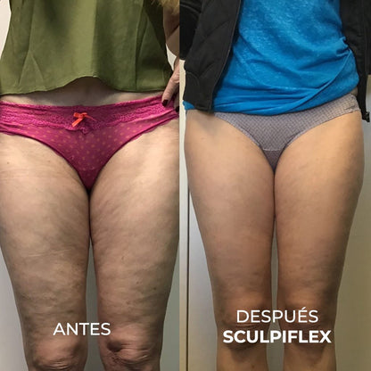 The Original Sculpiflex™ 3-in-1
