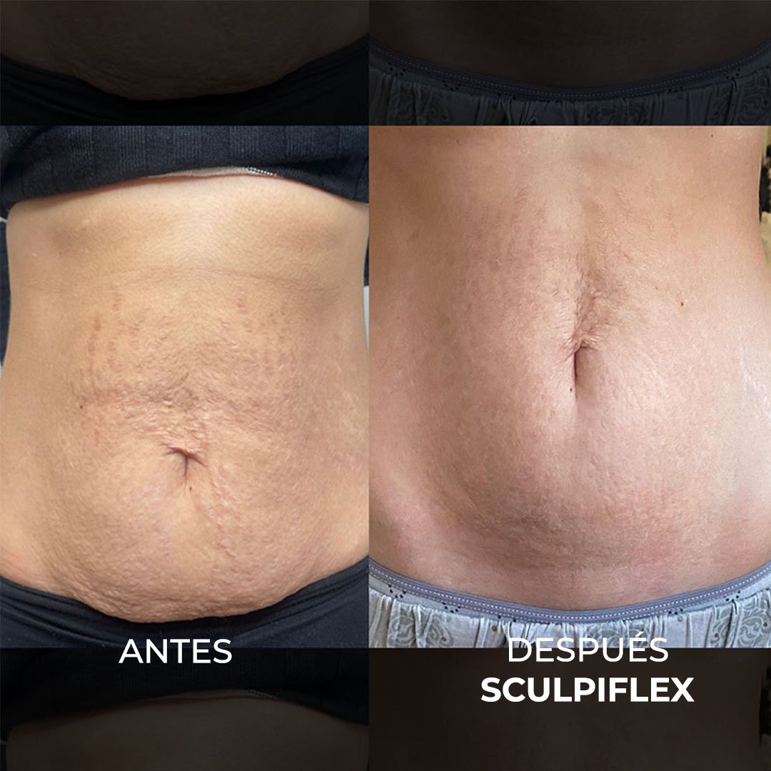 The Original Sculpiflex™ 3-in-1