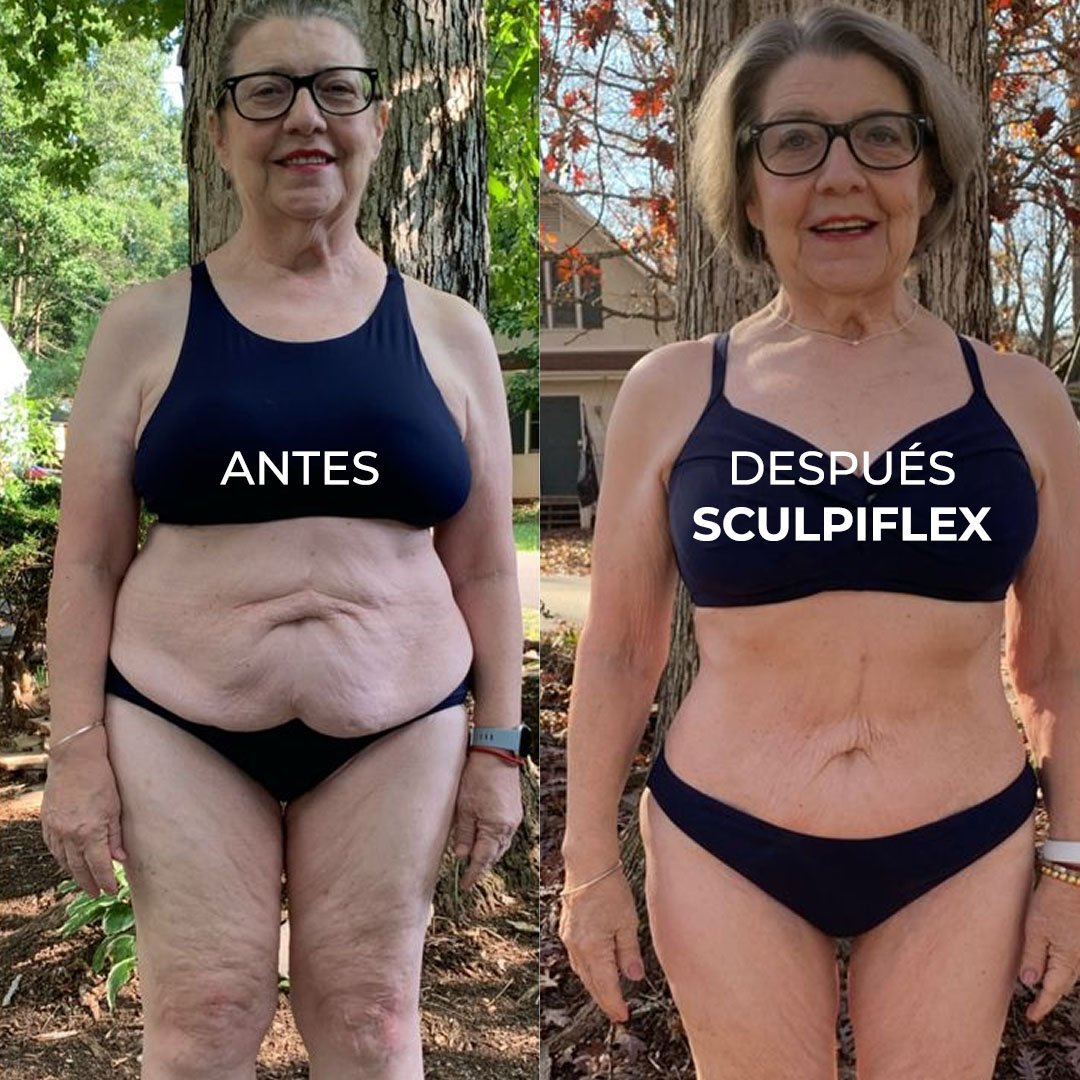 The Original Sculpiflex™ 3-in-1